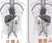 女子就医发现五脏六腑全长反 医生科普：镜面人 医学上无科学定论！