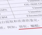 女子丰胸检出骆驼等动物源性成分 机构早在手术前3个月就被吊销执照！