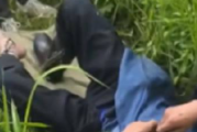 老人被五步蛇咬伤打16支血清保住脚趾 晚半个小时就有生命危险！