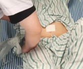 男子爱吃生腌胆道惊现7条虫  胆道内还有无数的虫卵！