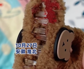 13岁女孩戴鲨鱼夹滑倒：头皮缝了3针 妈妈提醒大家尽量少戴！