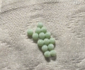 专家：衣服上发现荔蝽虫卵要当心！