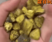 女生取24颗胆结石没事盘着玩 不少网友建议做成手串！