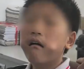 男孩把三角尺塞进嘴中被卡 消防赶到后将尺子夹碎取出！
