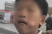 男孩把三角尺塞进嘴中被卡 消防赶到后将尺子夹碎取出！