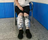 女子小腿绑藏73块手表进境 比大腿还粗 因步态异常被查!
