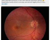马斯克：正在研发视觉芯片 可帮助失明者重见光明！