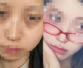 女生打工垮脸向老板索赔1万元“颜值折损费”成功 还给了3天的美容假！