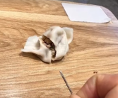 孩子吃水饺狂哭不止 家长拔出后发现居然是注射器针头！