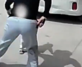 男孩把硬币塞进电车充电口被电 手指瞬间烧黑!