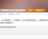 “会飞的硫酸”将进入活跃期：女子中招后眼皮腐烂！