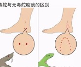 男子夜爬遭蛇咬倒地动弹不得 紧急处理措施来了：一共6点！