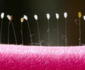 女子发现阳台上的衣架长出草蛉虫卵 究竟怎么回事