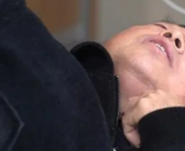 男子暴瘦痛苦求医 每次只能咽下一粒米！