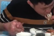 男子爱喝啤酒吃海鲜 患痛风双手变形已无法工作！