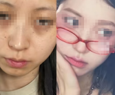 00后女生因打工累丑向公司索赔成功：1万元颜值折旧费！