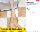 黄黑皮的救星 碘伏火成美白神器 专家警告！