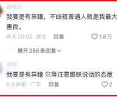 7岁女孩天生异瞳：妈妈担心受歧视 网友却集体羡慕!