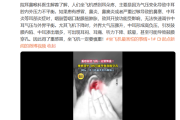 坐飞机害怕的事再+1！重感冒坐飞机可能导致鼓膜穿孔！