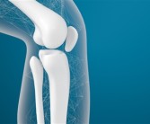 “伤筋动骨”真的100天才能恢复吗：恢复时长因人而异！