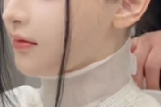 “长相完美”听障女孩植入人工耳蜗 正在进行语训康复!